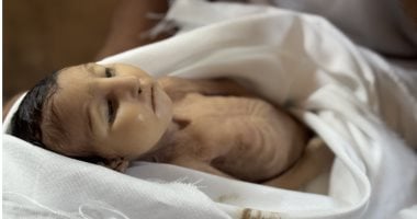 غدير ماتت من سوء التغذية..التجويع الإسرائيلي لغزة يقتل رضيع عمرها 5 شهور